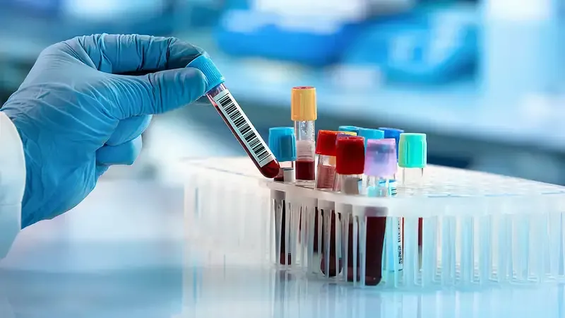 Phương pháp điều trị bệnh hột xoài 1