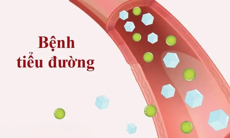 Cải thiện đời sống tình dục cho người bị tiểu đường 2