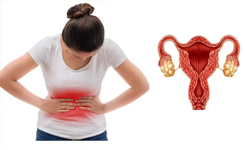 Cách phòng tránh bệnh đa nang buồng trứng 1
