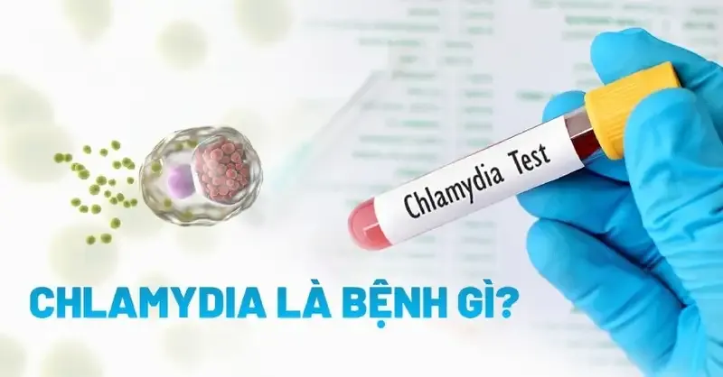 Bệnh Chlamydia có nguy hiểm không?