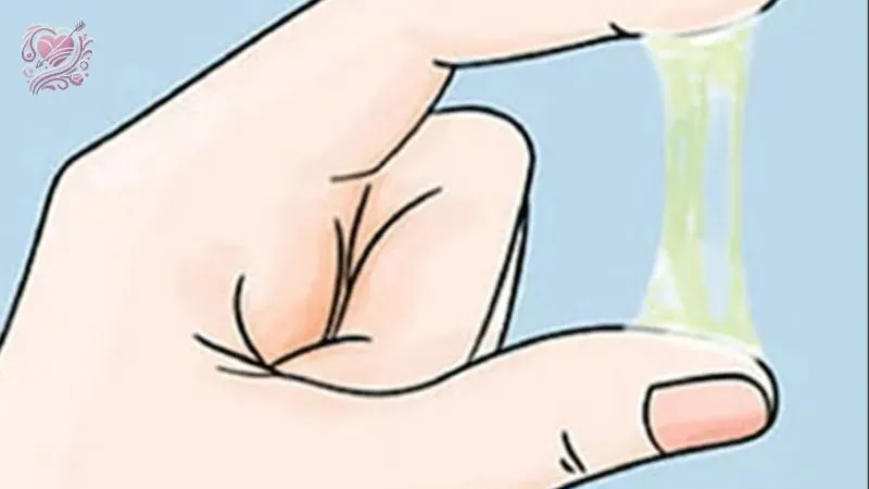 Phương pháp điều trị vô sinh ở nữ 