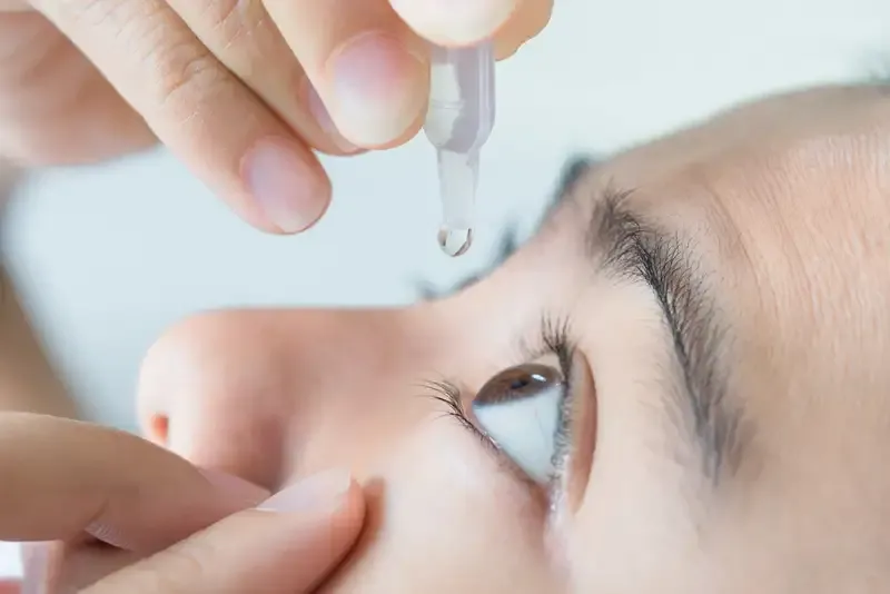 Phương pháp điều trị hội chứng Sjogren 2