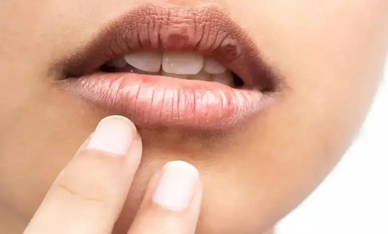 Phương pháp điều trị hội chứng Sjogren 4