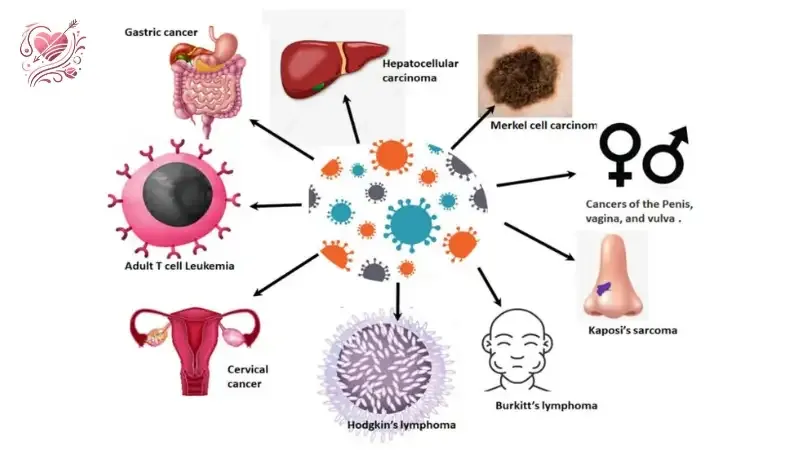 Cách điều trị virus HPV