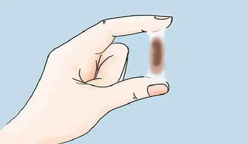 Một số câu hỏi thường gặp về máu báo thai 3