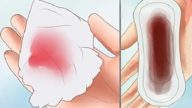 Phân biệt máu báo thai sau quan hệ với máu kinh nguyệt 2