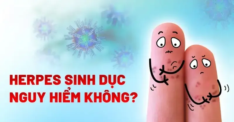 Tìm hiểu về mụn rộp sinh dục 1