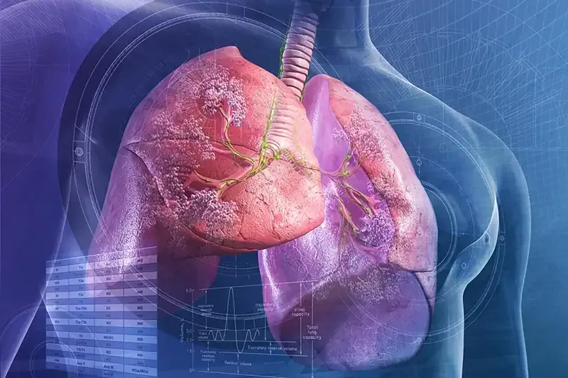 Triệu chứng của bệnh Mycoplasma genitalium