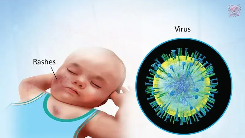 Chẩn đoán nhiễm Cytomegalovirus