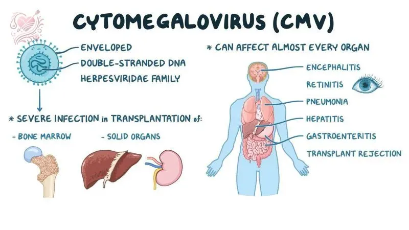 Nhiễm Cytomegalovirus là gì?