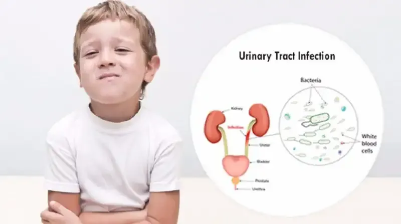 Nhiễm trùng đường tiết niệu mãn tính
