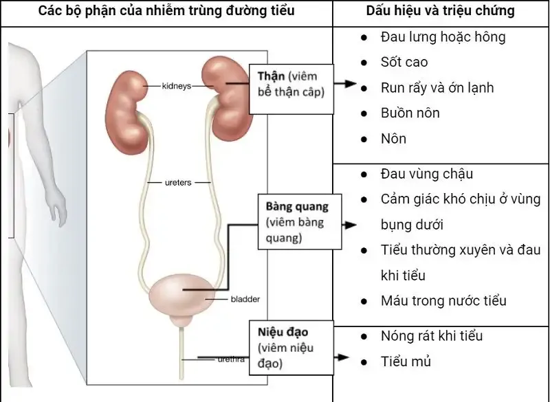 Cách điều trị bệnh nhiễm trùng đường tiết niệu