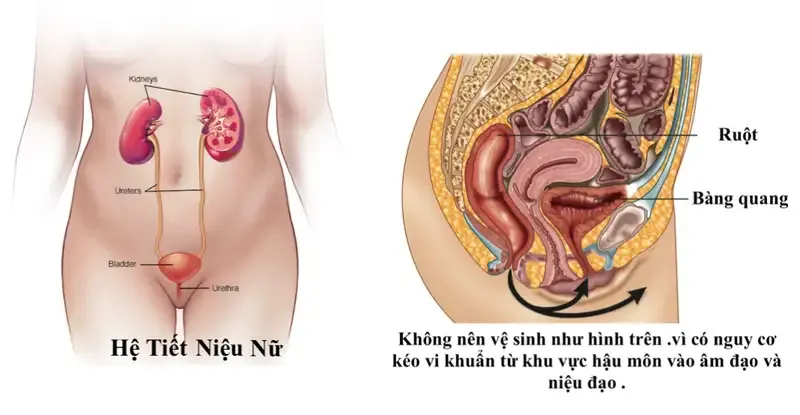 Cách phòng chống tái nhiễm trùng đường tiết niệu 1