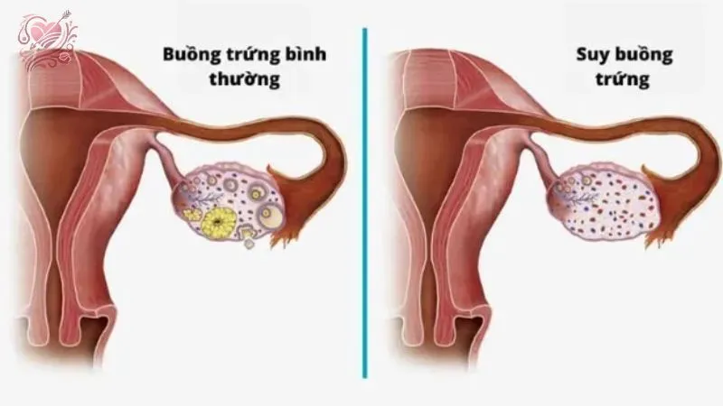 Phương pháp chuẩn đoán