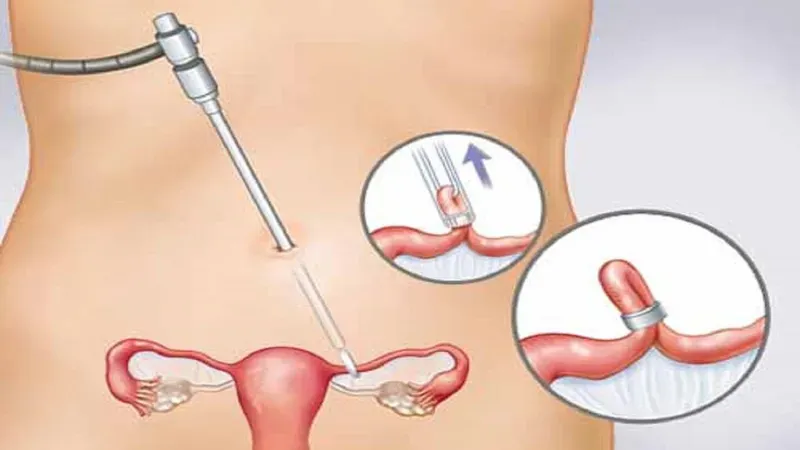 Các câu hỏi thường gặp?