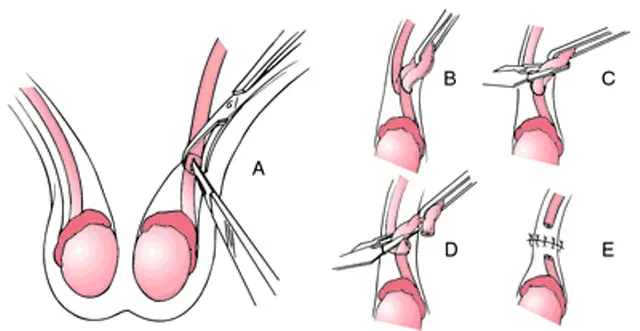 Làm sao để tìm một bác sĩ giỏi để thực hiện thủ thuật?