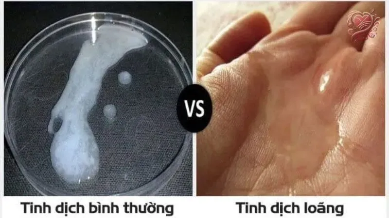 Quá trình sản xuất ra tinh trùng