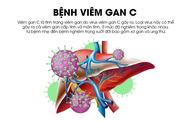 Tổng quan về bệnh viêm gan C