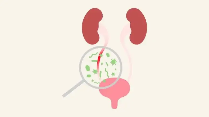 Chẩn đoán bệnh viêm niệu đạo không do lậu 2