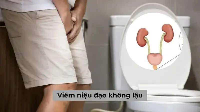 Viêm niệu đạo không do lậu là gì?