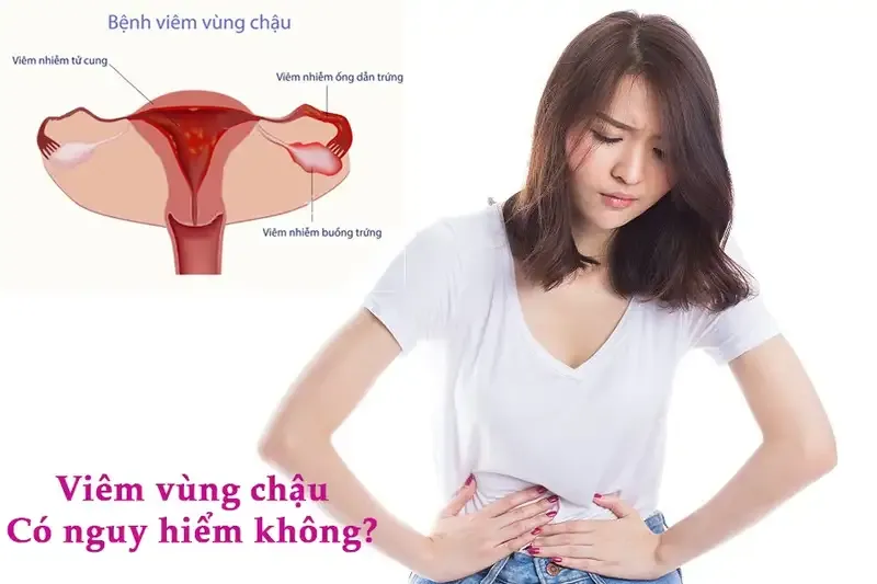 Nguyên nhân gây bệnh viêm vùng chậu