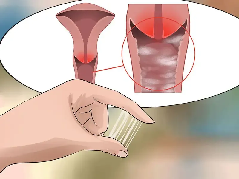 Những đối tượng có nguy cơ mắc bệnh viêm vùng chậu