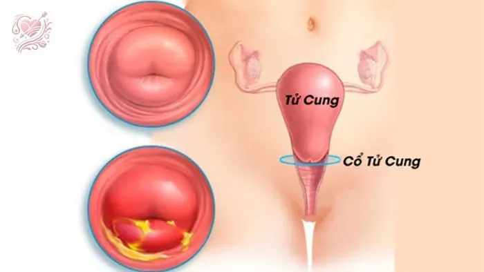Các phương pháp chữa vô sinh hiệu quả 