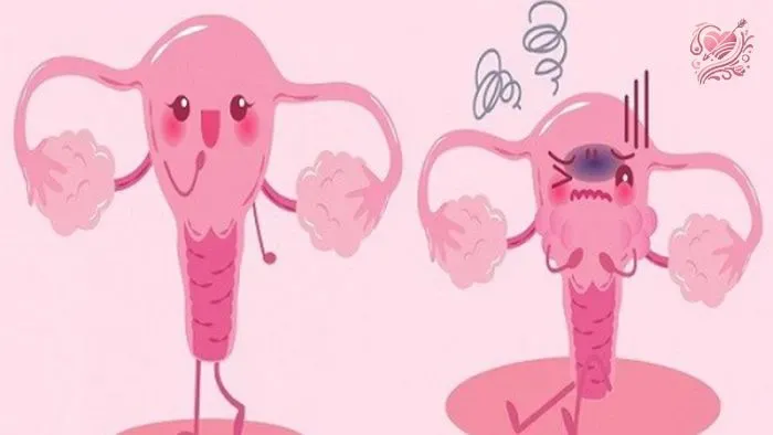 Một số lưu ý khi điều trị vô sinh
