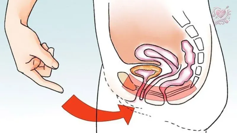 Xuất tinh ngược dòng có chữa được không?