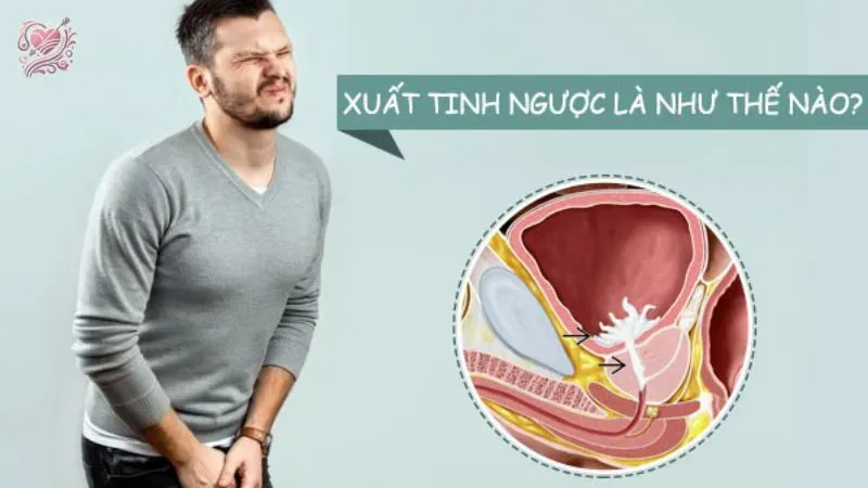 Chẩn đoán tình trạng xuất tinh ngược dòng như thế nào?