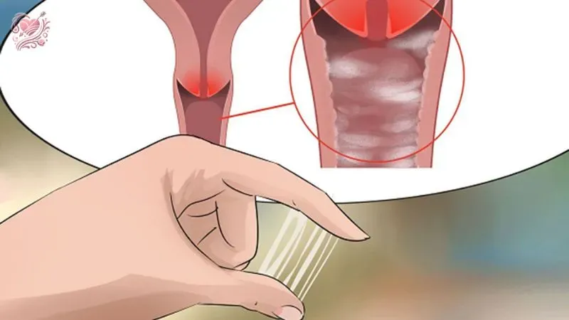Tinh dịch của nữ giới thường có màu gì?