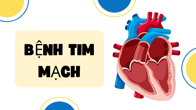 Bệnh tim mạch – triệu chứng và nguy cơ cần biết