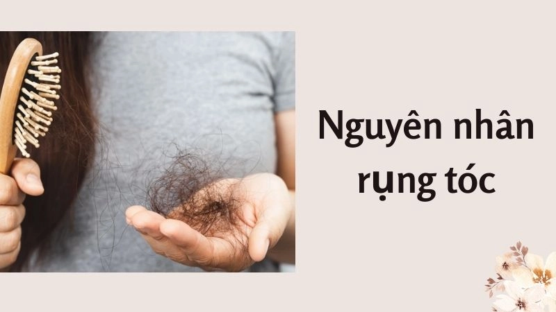 Top 10 nguyên nhân gây rụng tóc phổ biến nhất hiện nay